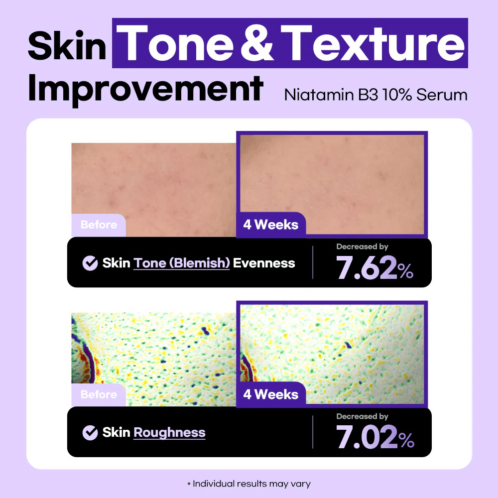 Lesimo Niatamin B3 10% Serum — image 1