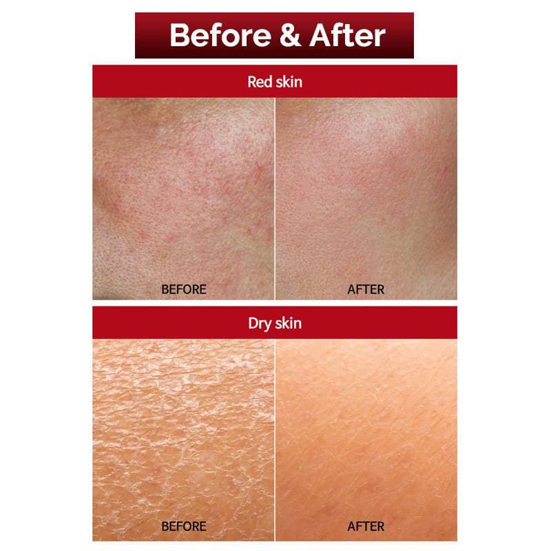 FAU SKIN SOLUTION SOS MASK — image 1